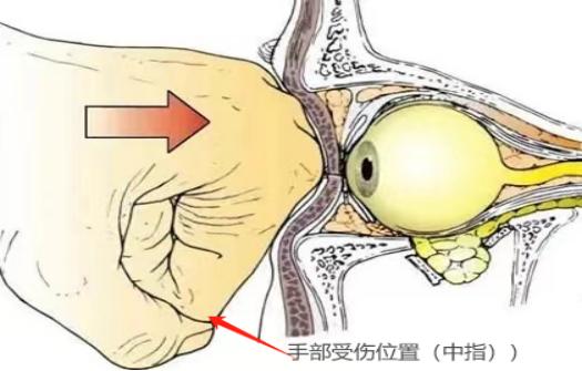 W某涉嫌故意伤害罪，内蒙古大川律师事务所明月律师为其辩护，获撤回起诉结果